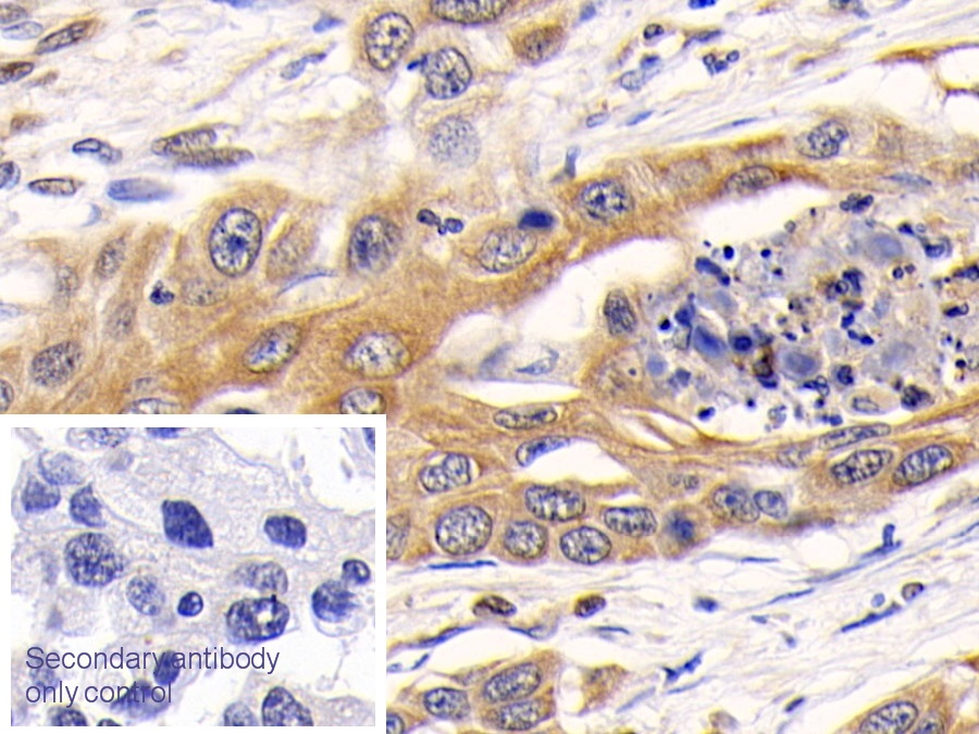 Polyclonal Antibody to Cathepsin K (CTSK)