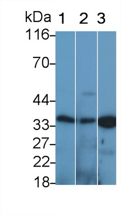 Polyclonal Antibody to Cathepsin K (CTSK)