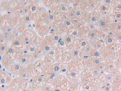 Polyclonal Antibody to Phospholipase C Gamma 1 (PLCg1)