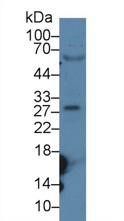 Polyclonal Antibody to Linker For Activation Of T-Cell (LAT)