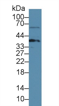 Polyclonal Antibody to Linker For Activation Of T-Cell (LAT)