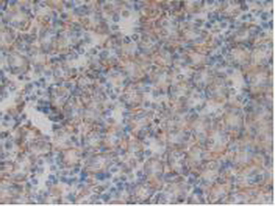 Polyclonal Antibody to Integrin Alpha D (ITGaD)