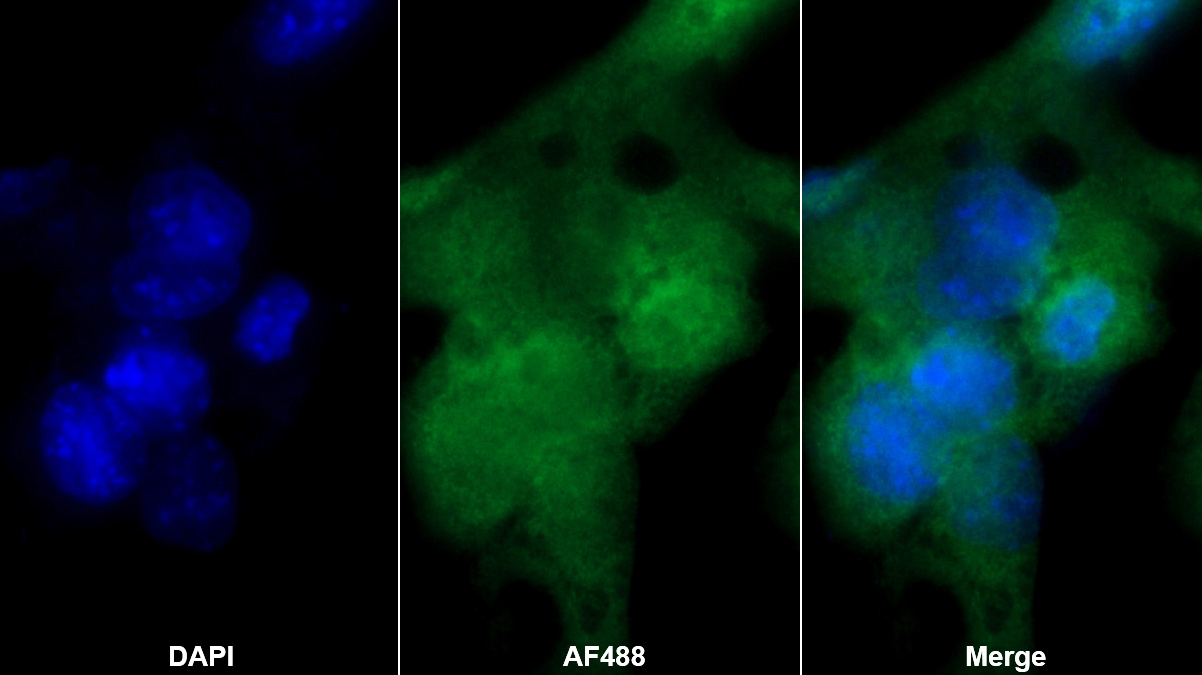 Polyclonal Antibody to Transportin 1 (TNPO1)