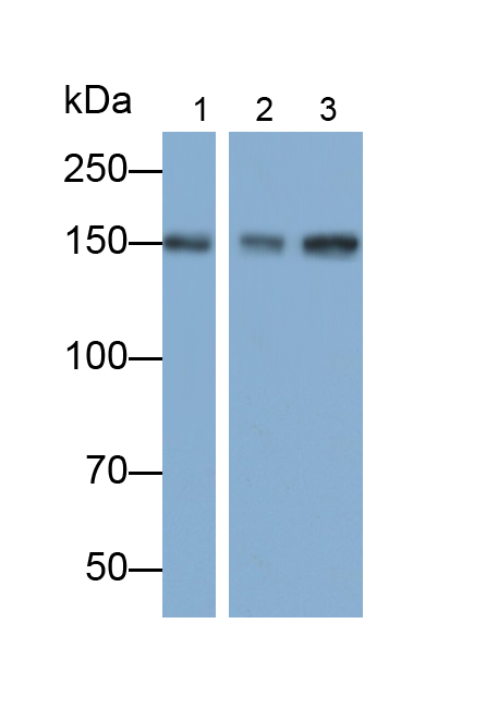 Polyclonal Antibody to Immunoglobulin superfamily, member 1 (IGSF1)