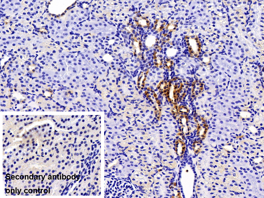 Polyclonal Antibody to Insulin Like Growth Factor Binding Protein 6 (IGFBP6)