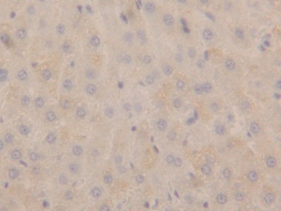 Polyclonal Antibody to Natriuretic Peptide Precursor A (NPPA)