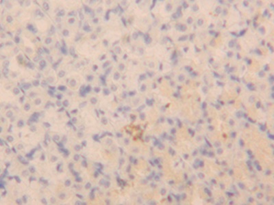 Polyclonal Antibody to Natriuretic Peptide Precursor A (NPPA)