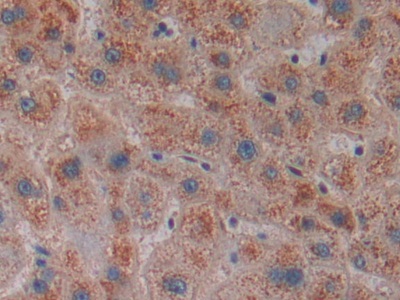 Polyclonal Antibody to Centromere Protein E (CENPE)