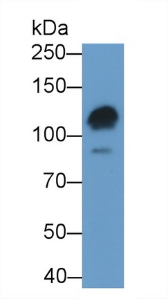 Polyclonal Antibody to Poly ADP Ribose Polymerase (PARP)