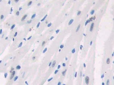 Polyclonal Antibody to Poly ADP Ribose Polymerase (PARP)