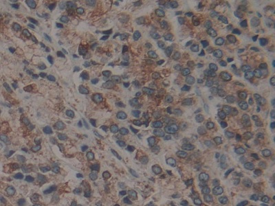 Polyclonal Antibody to Calnexin (CNX)