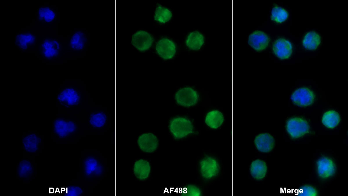 Polyclonal Antibody to B-Cell Activation Factor Receptor (BAFFR)