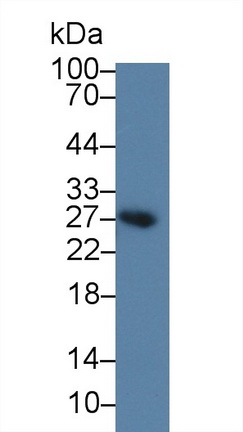 Polyclonal Antibody to B-Cell Activation Factor Receptor (BAFFR)