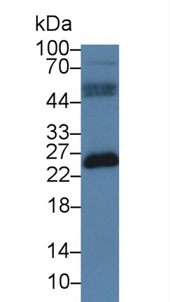 Polyclonal Antibody to B-Cell Activation Factor Receptor (BAFFR)