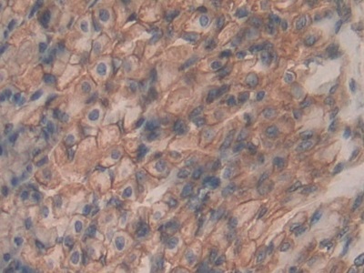 Polyclonal Antibody to Alpha-Fodrin (SPTAN1)