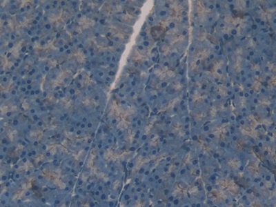 Polyclonal Antibody to Alpha-Fodrin (SPTAN1)