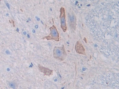 Polyclonal Antibody to Alpha-Fodrin (SPTAN1)