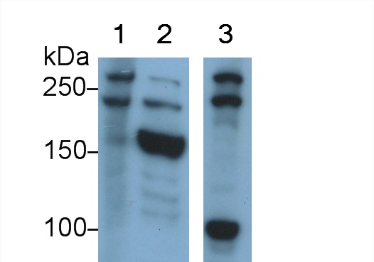 Polyclonal Antibody to Alpha-Fodrin (SPTAN1)