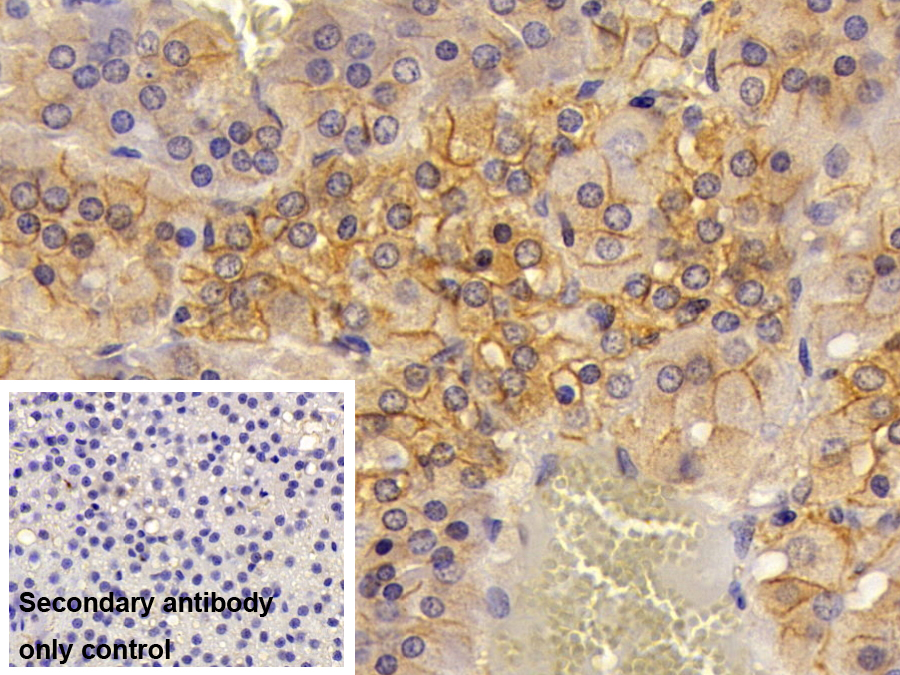 Polyclonal Antibody to Alpha-Fodrin (SPTAN1)