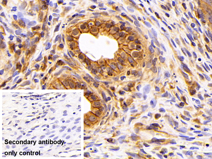 Polyclonal Antibody to Alpha-Fodrin (SPTAN1)