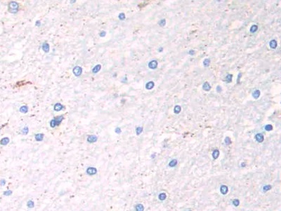 Polyclonal Antibody to Glutamate Dehydrogenase 1 (GLUD1)