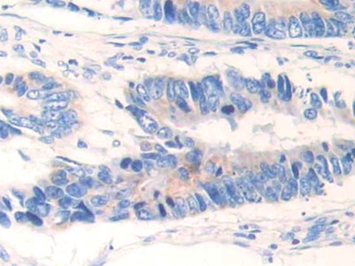 Polyclonal Antibody to Glutamate Dehydrogenase 1 (GLUD1)