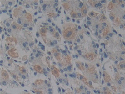 Polyclonal Antibody to Glutathione Peroxidase 1 (GPX1)