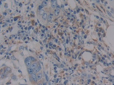 Polyclonal Antibody to Glutathione Peroxidase 1 (GPX1)