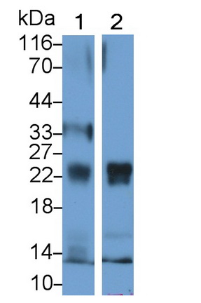 Polyclonal Antibody to Glutathione Peroxidase 1 (GPX1)