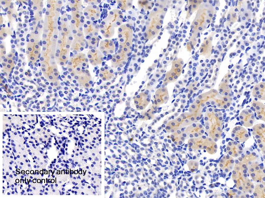 Polyclonal Antibody to Glutathione Peroxidase 1 (GPX1)