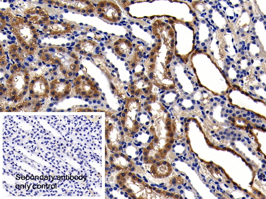 Polyclonal Antibody to Glutathione Peroxidase 1 (GPX1)