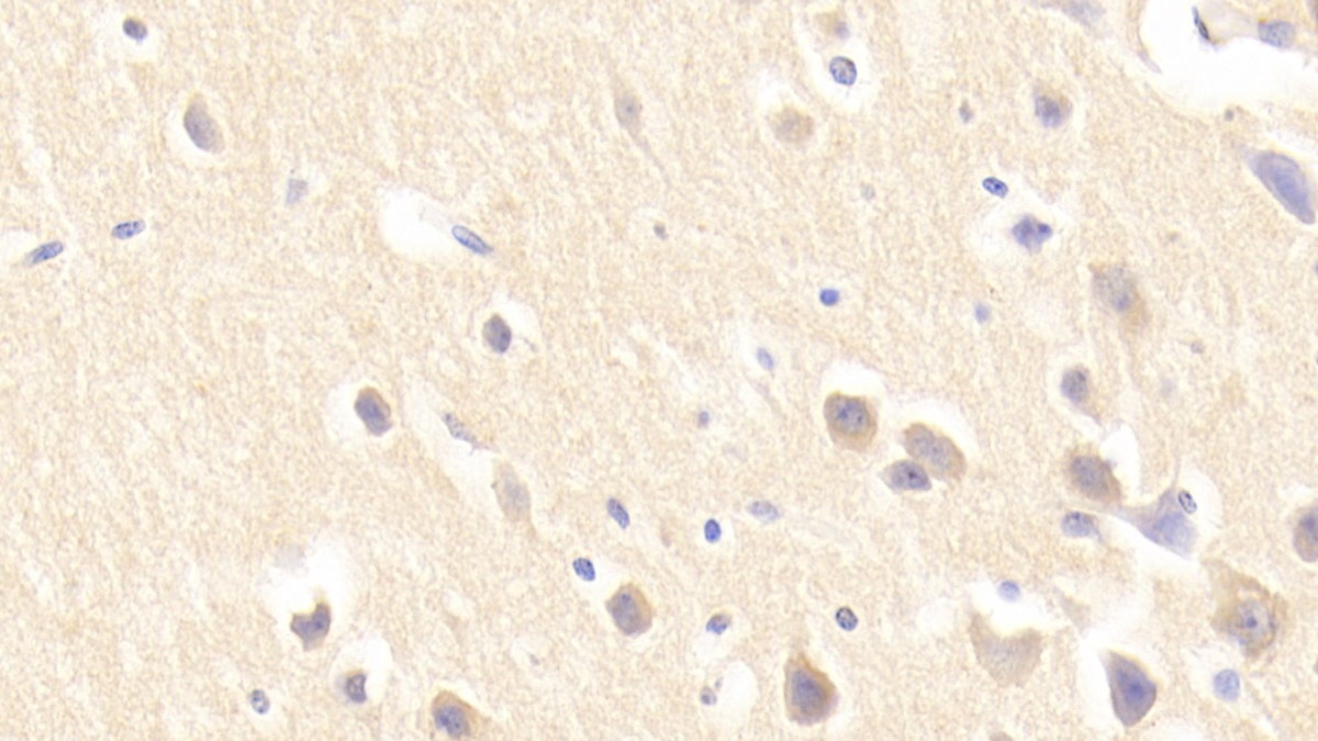 Polyclonal Antibody to Neuronal Pentraxin I (NPTX1)