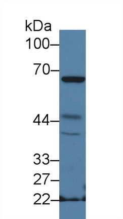 Polyclonal Antibody to Neutrophil Cytosolic Factor 2 (NCF2)