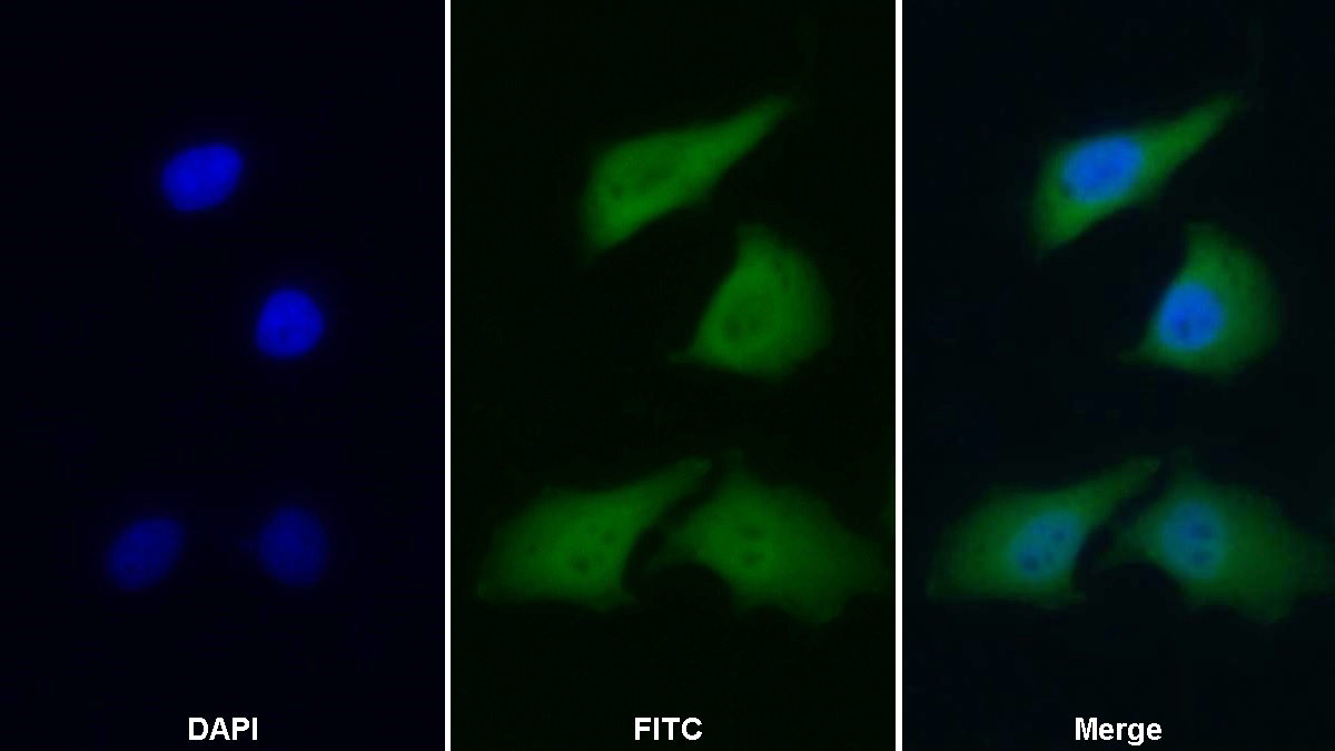 Polyclonal Antibody to Heat Shock 70kDa Protein 1B (HSPA1B)