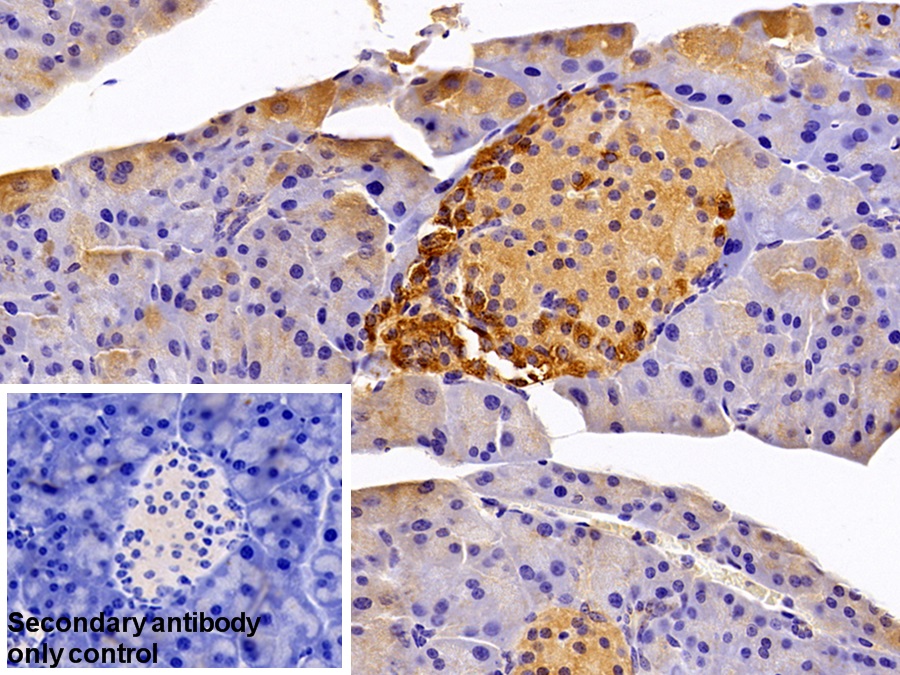 Polyclonal Antibody to Galectin 2 (GAL2)