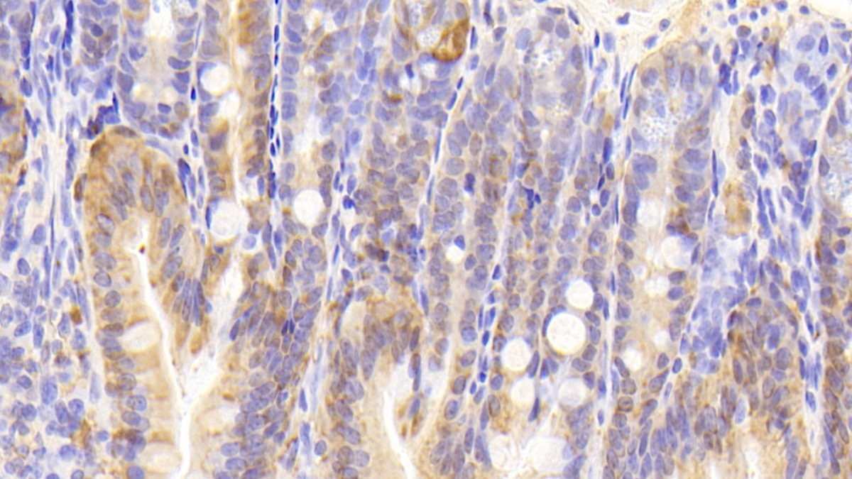 Polyclonal Antibody to Galectin 2 (GAL2)