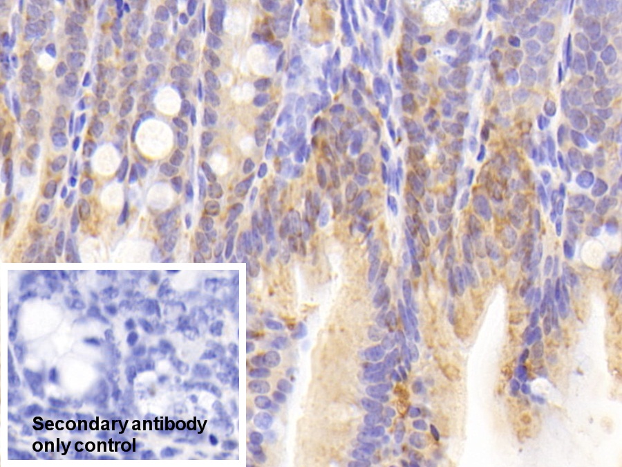 Polyclonal Antibody to Galectin 2 (GAL2)