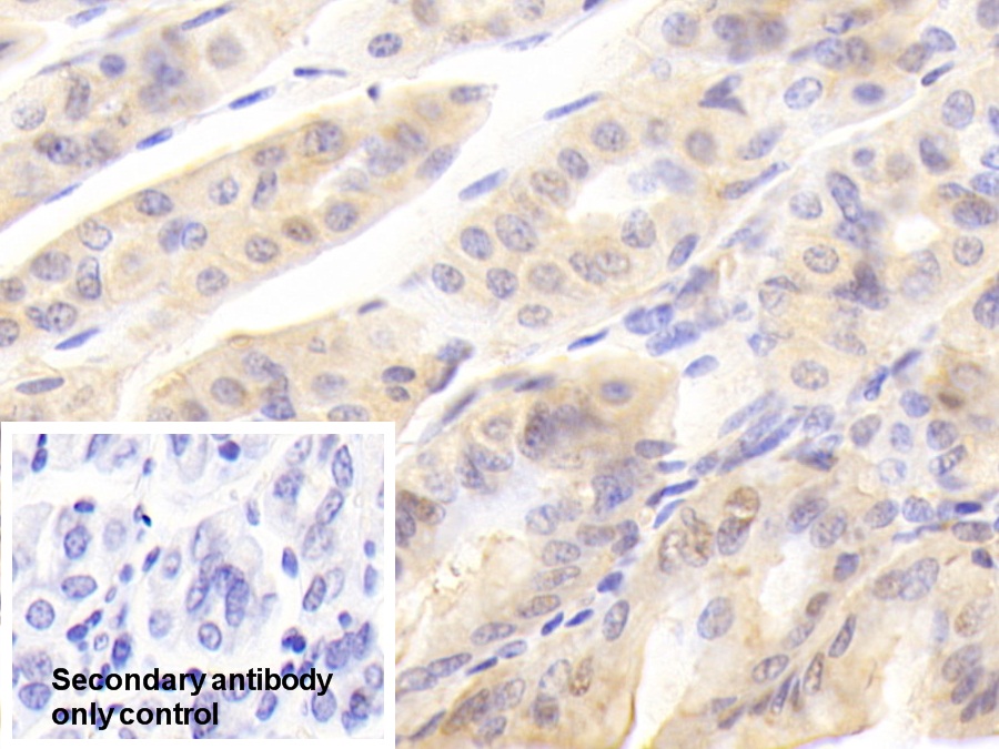 Polyclonal Antibody to Galectin 2 (GAL2)