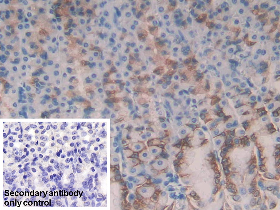 Polyclonal Antibody to Galectin 2 (GAL2)