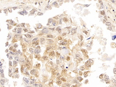 Polyclonal Antibody to Galectin 3 (GAL3)