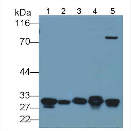 Polyclonal Antibody to Galectin 3 (GAL3)