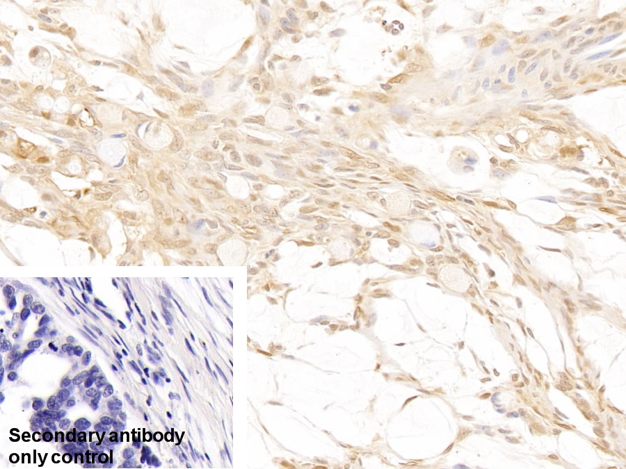 Polyclonal Antibody to Galectin 3 (GAL3)