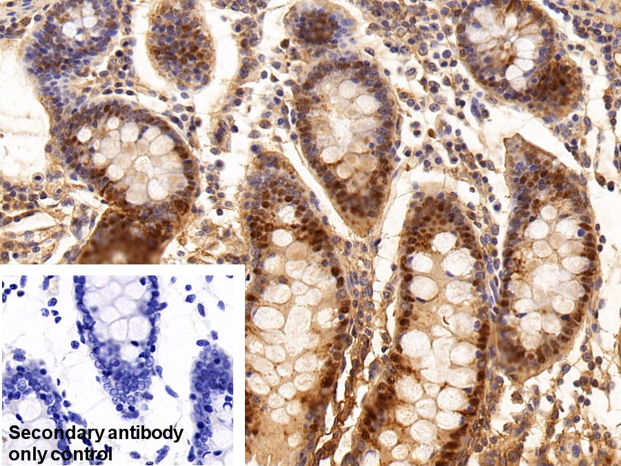 Polyclonal Antibody to Galectin 3 (GAL3)