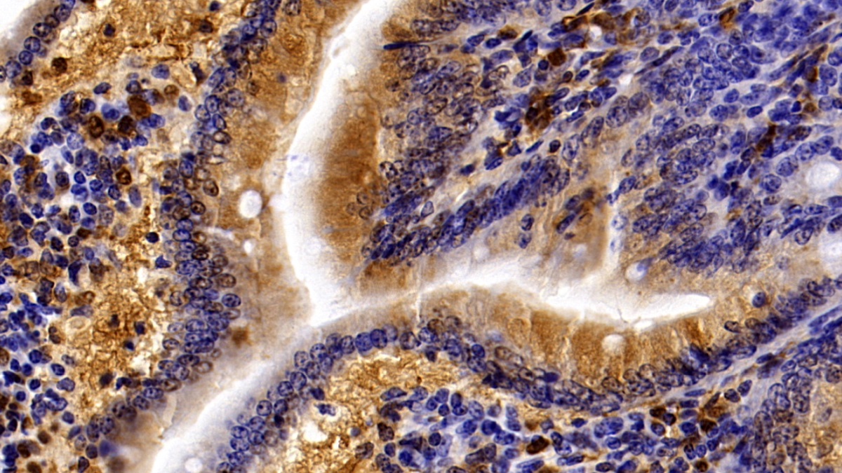 Polyclonal Antibody to Galectin 3 (GAL3)