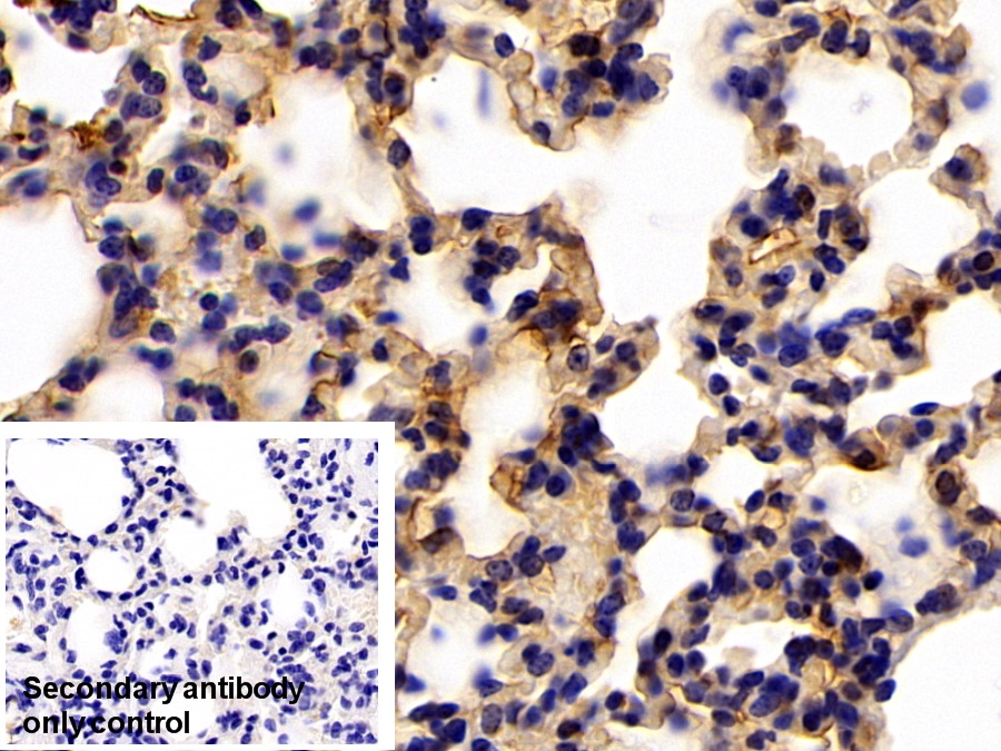 Polyclonal Antibody to Galectin 3 (GAL3)