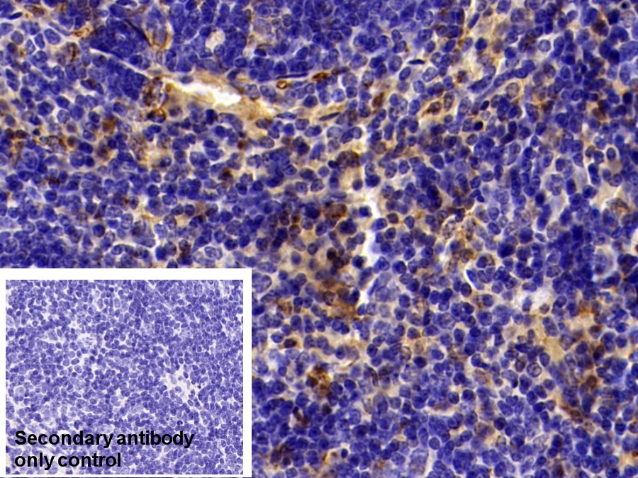 Polyclonal Antibody to Galectin 3 (GAL3)