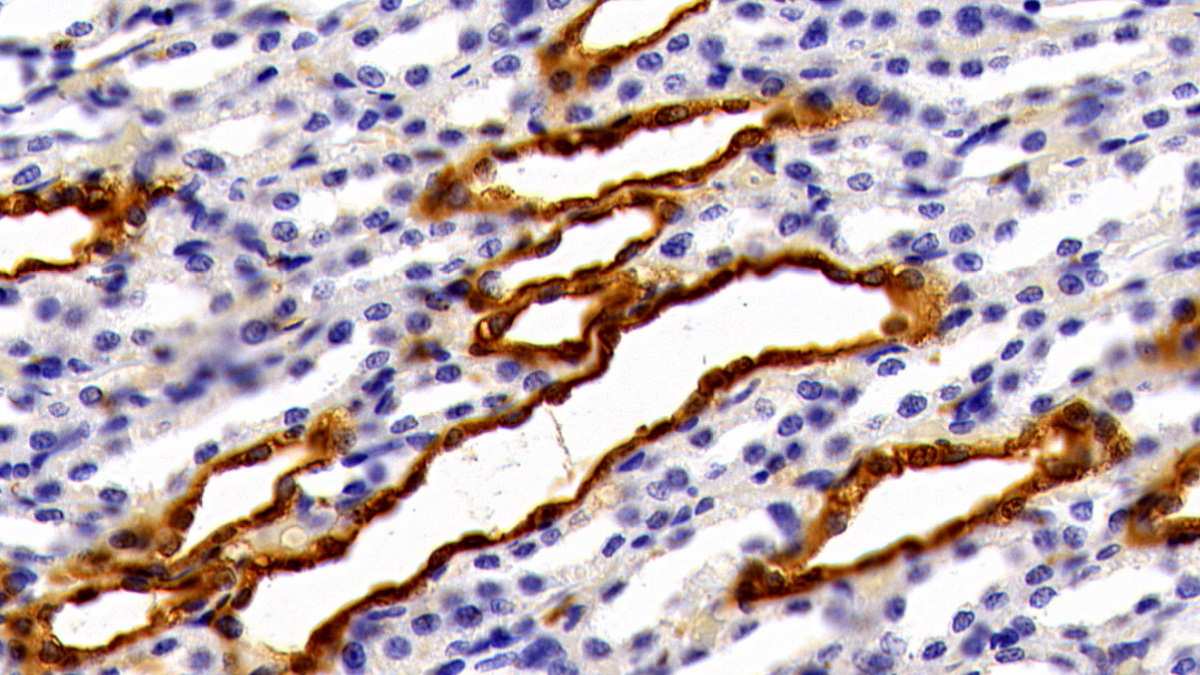 Polyclonal Antibody to Galectin 3 (GAL3)