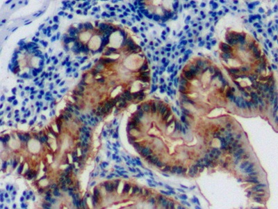 Polyclonal Antibody to Galectin 3 (GAL3)