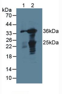 Polyclonal Antibody to Galectin 4 (GAL4)