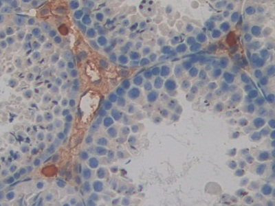 Polyclonal Antibody to Galectin 4 (GAL4)